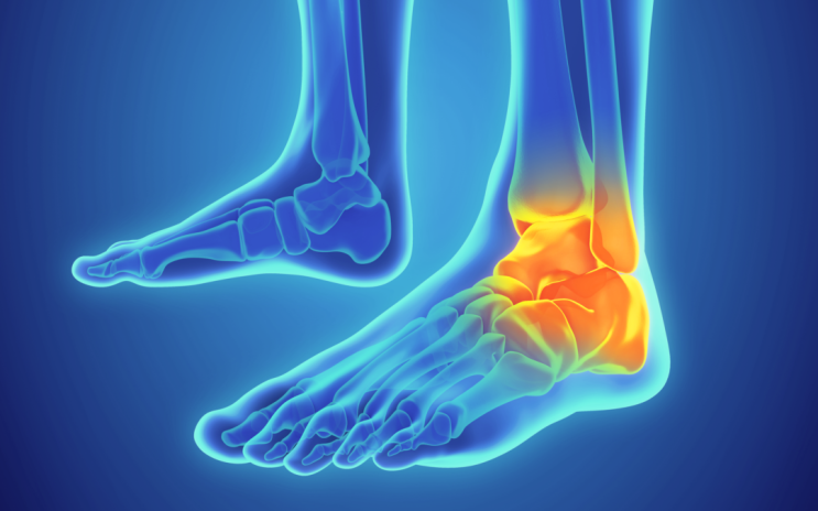 발목 부상 재활 방법